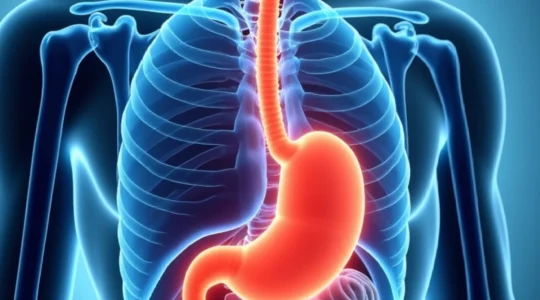 unusual-hiatal-hernia-symptoms-including-back-pain