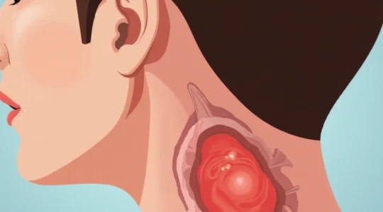 lump-at-the-back-of-the-neck-near-the-hairline-possible-causes